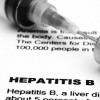 Hepatitis B