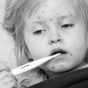 Measles