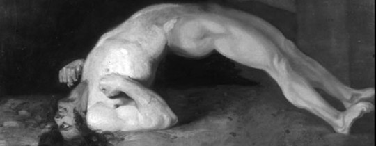 Opisthotonus in a patient suffering from tetanus - Painting by Sir Charles Bell - 1809